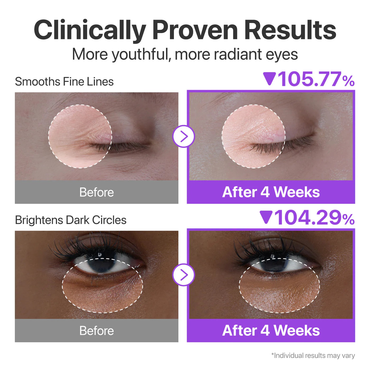 NAD+ Retinol Eye Cream.