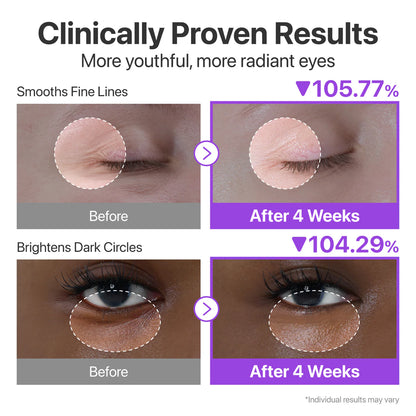 NAD+ Retinol Eye Cream.
