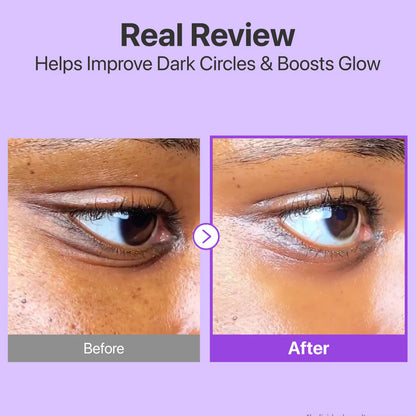 NAD+ Retinol Eye Cream.